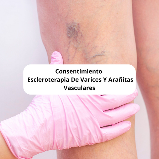 Consentimiento Escleroterapia De Varices Y Arañitas Vasculares